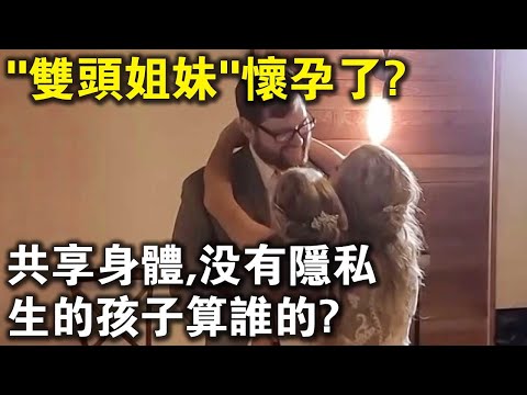 共享身體，沒有隱私，生的孩子算誰的？美國“雙頭姐妹”被曝懷孕，網友先吵翻了？