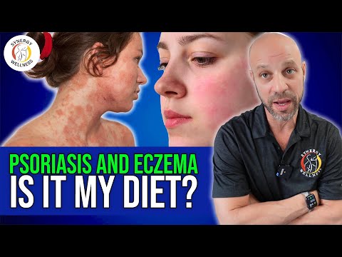 Psoriasis & Eczema, Is it my Diet?