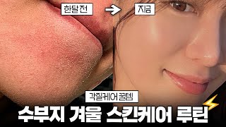 각질폭탄 수부지 겨울철 올리브영 추천템 ▶️ 화장 잘 먹는 스킨케어 루틴