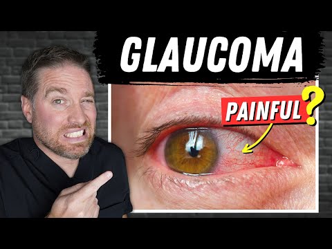 Open Vs Closed Angle Glaucoma (Painful Glaucoma!)