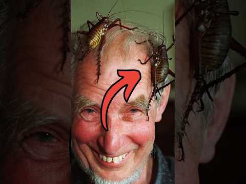 What’s Crawling on His Forehead?