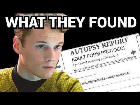 FREAK ACCIDENT killed Anton Yelchin: AUTOPSY