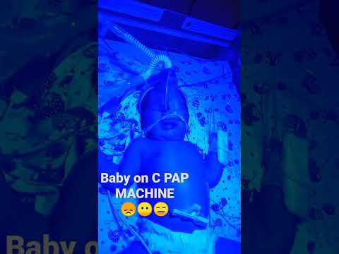 #newborn#machine#baby #cpapmask #shorts#viral #youtubeshorts#youtube @askyourdoctor2905 #shortsfeed