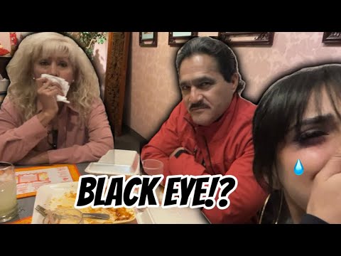 BLACK EYE PRANK ON MY FAMILY