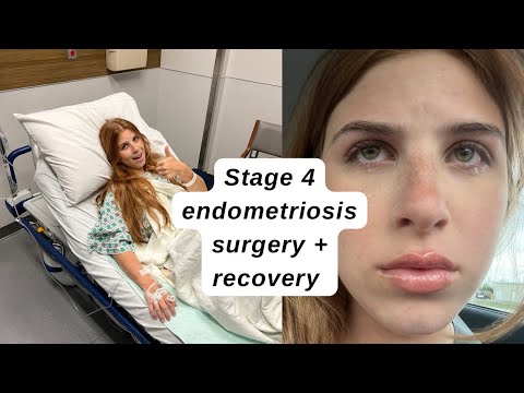 Stage 4 Endometriosis excision surgery vlog!!! (Staying at the hospital overnight)