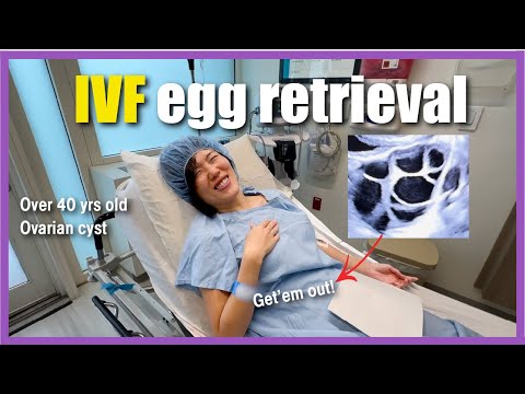 IVF Egg Retrieval Day Vlog: How Many Eggs? What to Expect. IVF journey over 40, TTC over 40