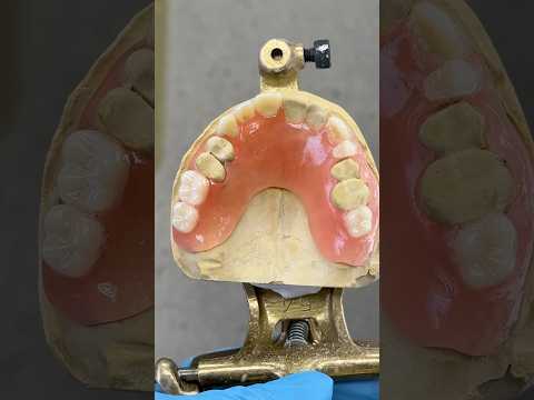 Filling in the gaps #lsk121shorts #dentist #teeth