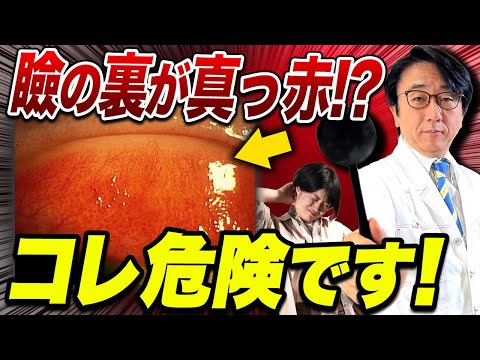 結膜炎だけでは済まない！実は怖いアノ病気だった！？