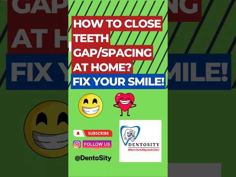 Fix your smile at home easily - How to close teeth Gap / Spacing at home easily? #teethgapmakeover