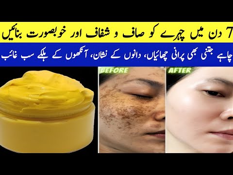 How To Remove Dark Spots, Pigmentation | Remove Pigmentation on Face