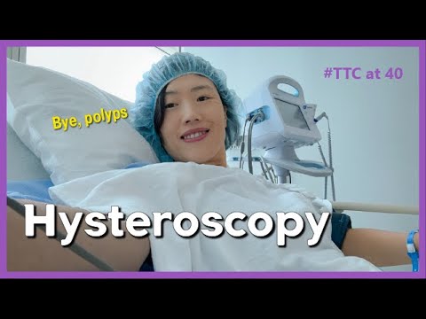 Hysteroscopy Vlog, Uterine Polyp Removal, Trying to Conceive at 40 after a miscarriage. Ovarian Cyst