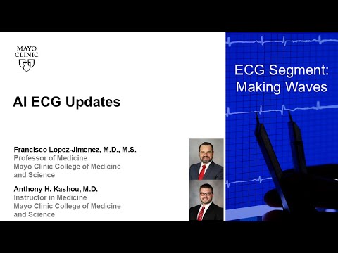 AI ECG Updates