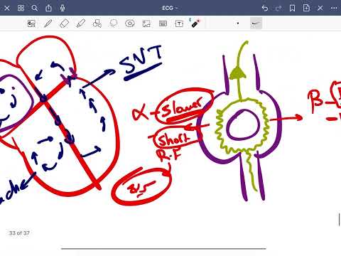 Sick sinus syndrome , WPW