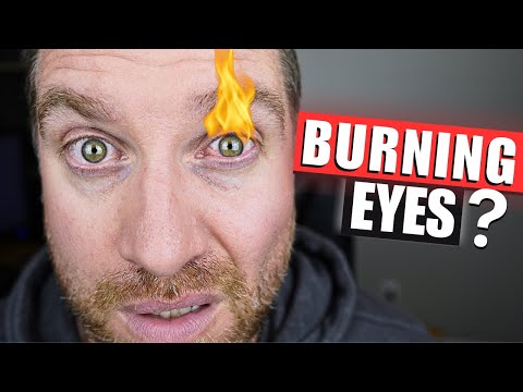 How To Stop Your Eyes From Burning! (5 Causes and Treatments)