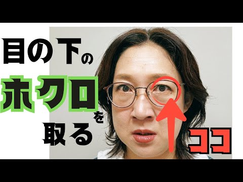 【ホクロを取る虻川】大きくなり悩んでいたけど目元だから心配で取れなかったけど取ったどー！