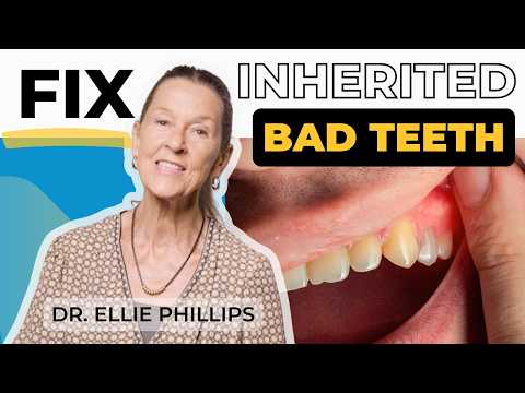 Fix Your Inherited Bad Teeth Today!