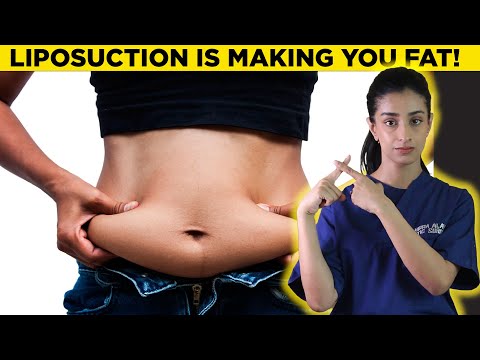 Does liposuction increase fat in other areas? Dr. Hirra Alavi