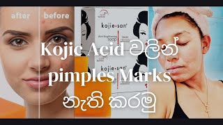 Kojic acid for skin lightening | පැහැපත් කැළැල් නැති සමකට kojic acid 🦋☘️ #kojicacid #sinhala