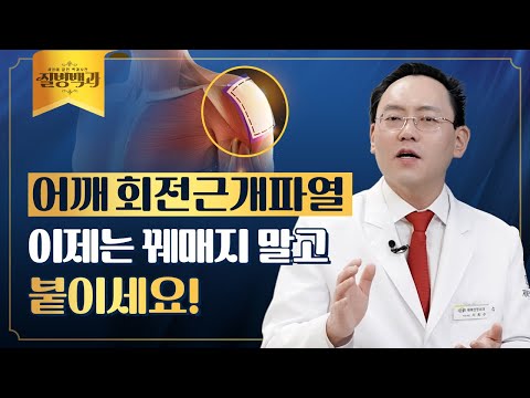 회전근개파열 힘줄 재생 치료, 콜라겐 임플란트란? | 질병백과