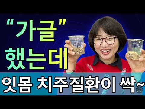 정말 가글만 했어요! 잇몸염증 치주질환 시린이 등 아픈 잇몸 증상이 놀라울 정도로 싹 사라졌어요!