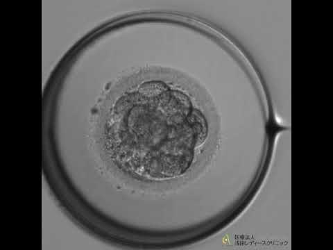 最新タイムラプス観察：受精から胚盤胞までの成長②