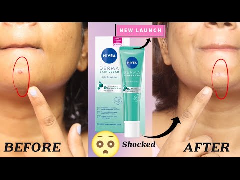 NIVEA Derma Skin Clear Exfoliator Review | 8% Salicylic, Glycolic Acid,  Fight Blemishes Acne Mark |