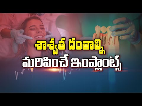 Dental implants | సహజ దంతాల్ని మరిపించే ఇంప్లాంట్స్ | Sukhibhava | 9th Jan 2025 | ETV Life