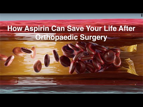 Aspirin Can Prevent Life-Threatening Blood Clots After Orthopedic Surgery For A Lot Less Money