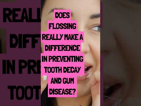 Does Flossing really makes a difference in preventing tooth decay and gum disease?Answer in comments