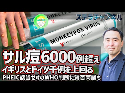 【サル痘】解説、世界の確定例6000例超え【サイエンス誌、CDC、グローバルヘルスの動向、健康】