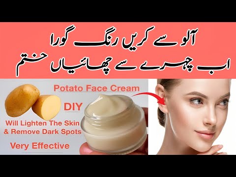 Homemade Potato Cream | How To Make Potato Juice for Face | Remove Dark Spot,Suntan,Pigmentation