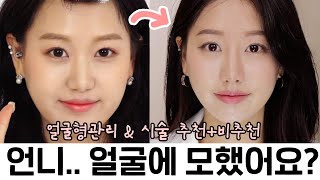 볼살, 심부볼러 필수👀내돈내산 시술들 추천VS비추천(부작용) 갑니다😮 ㅣ 인보라INBORA