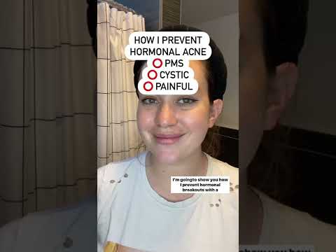 How I prevent hormonal acne with benzoyl peroxide