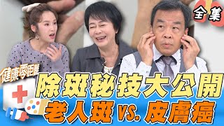 斑愈多=皮膚癌？這兩處出現不明黑痣 恐是致命癌症 都市傳說：抹香蕉皮可以除斑？專家教你有效根除老人斑點！｜健康零距離 EP255 完整版