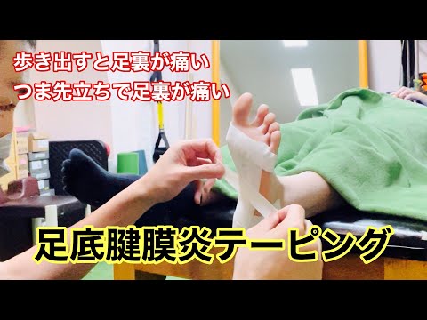 足底腱膜炎テーピング