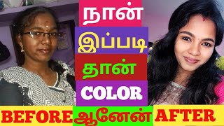 How I change my skin tone | 100℅ True | Skin whitening tips | skin transformation Before & After