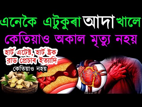 এনেকৈ এটুকুৰা আদা খালে কেতিয়াও অকাল মৃত্যু নহয় | হাৰ্ট এটেক্ট, হাৰ্ট ষ্ট্ৰক | ab smarttips