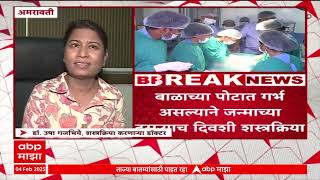 Buldhana : जन्मलेल्या बाळाच्या पोटातून 2 अविकसित गर्भांचे अवशेष काढण्यात यश