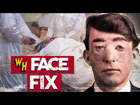 The Crazy True Story Of The First Plastic Surgery In History