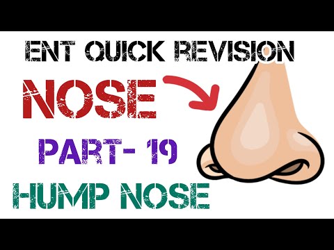 Hump Nose Deformity: Causes, Treatment Options, and Donor Sites for Bone & Cartilage