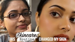 MY SKINCARE ROUTINE - MORNING & NIGHT | INDIAN SKIN CARE ROUTINE 2021 | HYPERPIGMENTATION SKIN CARE