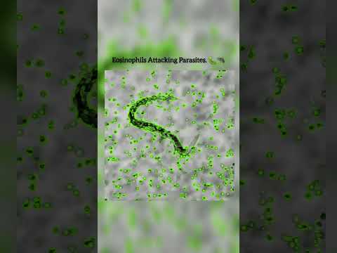 Eosinophils Attacking Parasites #shorts #shortvideo #shortsfeed #youtube #eduction