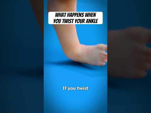 What happens when you twist your ankle?