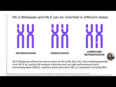 Compound Heterozygosity for Hemoglobin G-Makassar – Video abstract [432849]