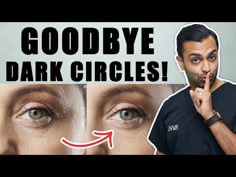 How to Get Rid of Dark Circles: Top Treatments That Work - Expert Advice