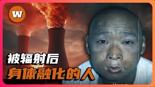 被核輻射後！看著身體融化的人，日本東海村JCO臨界事故｜老吳tv