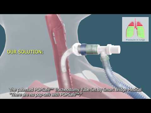 The patented POPSafe™ Tracheostomy Tube Set by Smart Bridge Medical - 3D Medical Animation