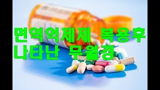 면역억제제 복용후 나타난 무월경 Rheumatoid Arthritis