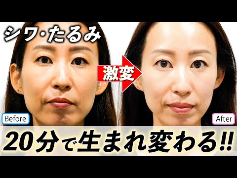 【40代のお悩み】たった1回の鍼治療で20年前の肌に若返る！たるみ肌が劇的改善！