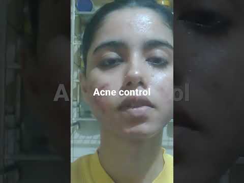 ance control face wash#shorts #shortsindia #youtubeshorts #ashortaday